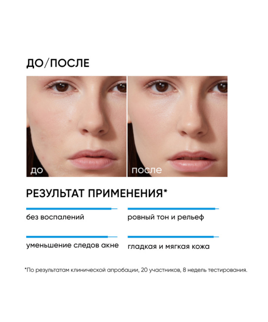 Icon skin Пилинг для проблемной кожи / PEELING 18% for oily and combination acne prone skin, 30мл (2)