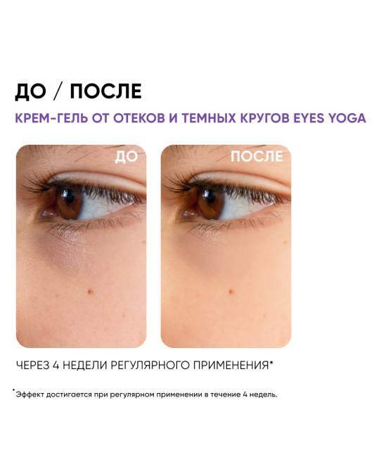 Icon skin Крем-гель для кожи вокруг глаз от отеков и темных кругов, 30мл (5)