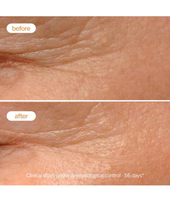 NOVExpert Крем-пилинг для лица Ночной, 40мл (4)