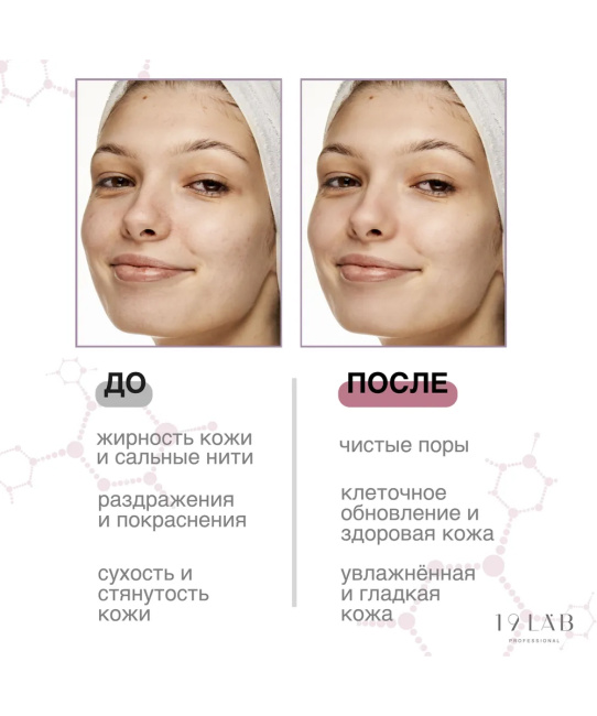 19 LAB Пенка для умывания Anti-Acne для проблемной и жирной кожи, 160мл (3)