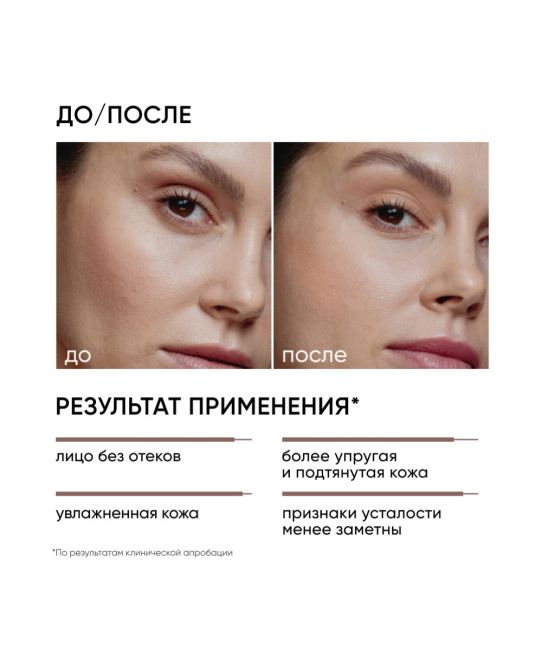 Icon skin Лимфодренажный тоник Skin Gym, 150мл (4)