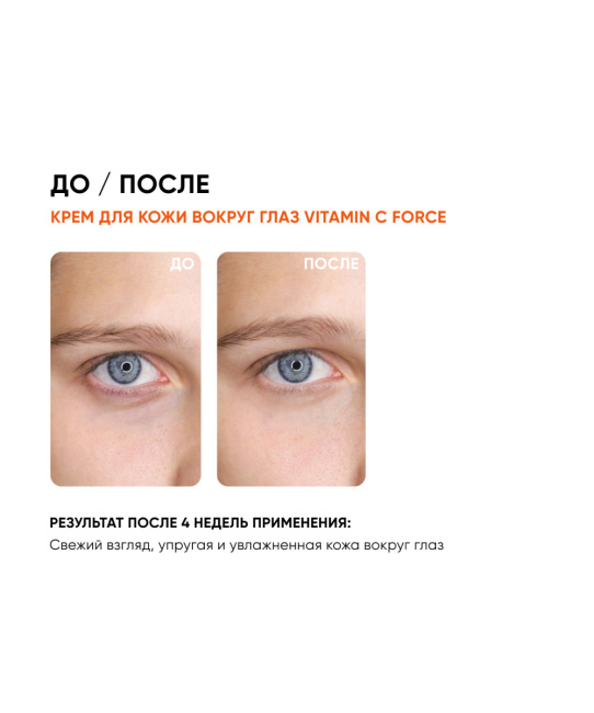 Icon skin Крем для кожи вокруг глаз с витамином С, 175мл (3)