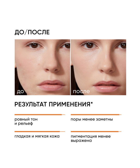 Icon skin Cмарт-пилинг система 12% Миндальная, 30мл (2)