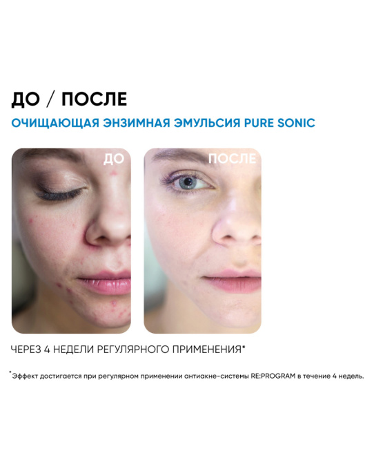 Icon skin Энзимная эмульсия очищающая для умывания, 150мл (2)