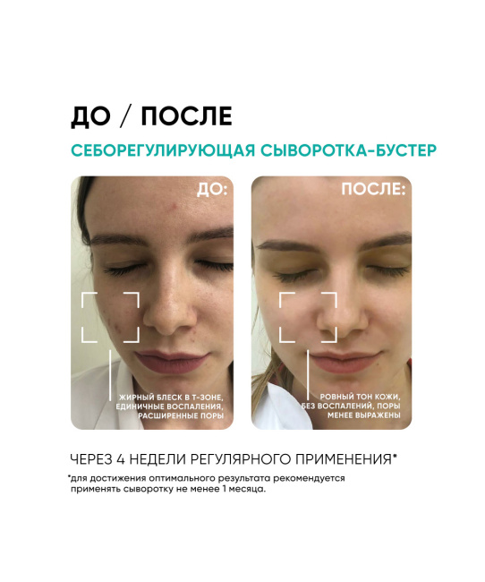 Icon skin Сыворотка-концентрат для лица себорегулирующая, 30мл (5)
