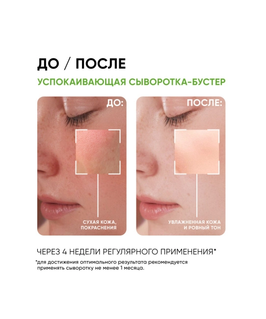 Icon skin Сыворотка-концентрат для лица успокаивающая, 30мл (5)