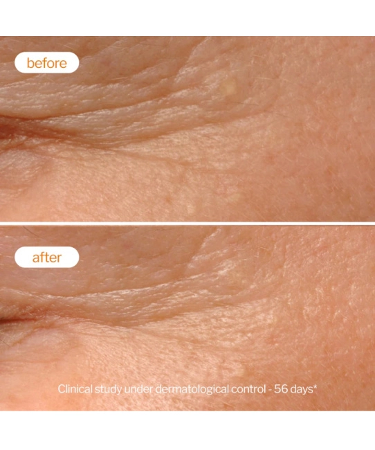 NOVExpert Крем-пилинг для лица Ночной, 40мл (4)