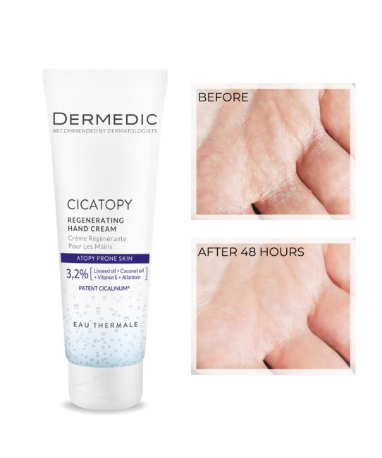 Dermedic Крем регенерирующий для рук, 75мл (1)
