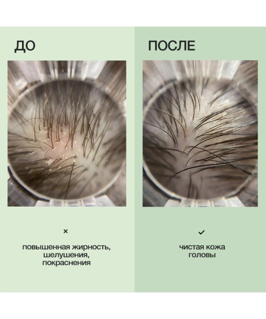 Limba Cosmetics Детокс-шампунь, 300мл (3)
