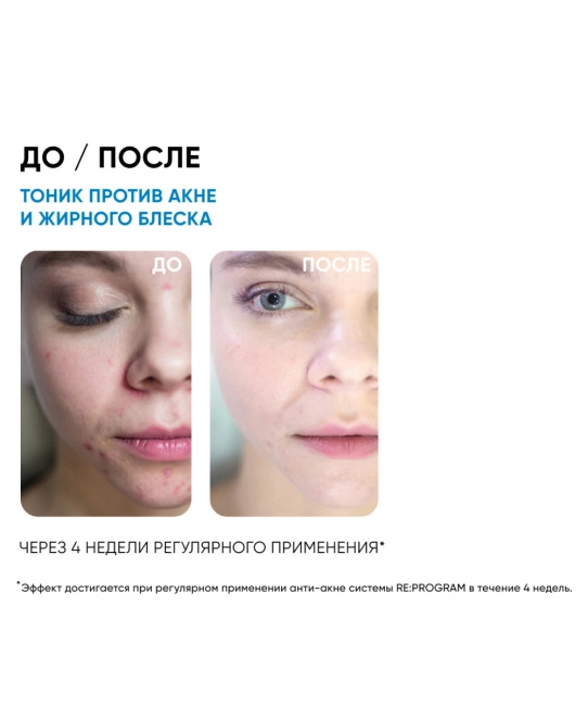 Icon skin Тоник-активатор для лица очищающий, 150мл (5)