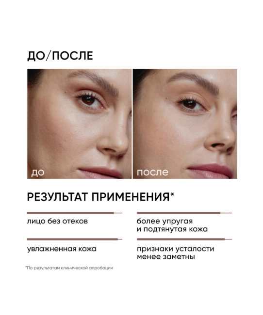 Icon skin Лимфодренажный тоник Skin Gym, 150мл (4)