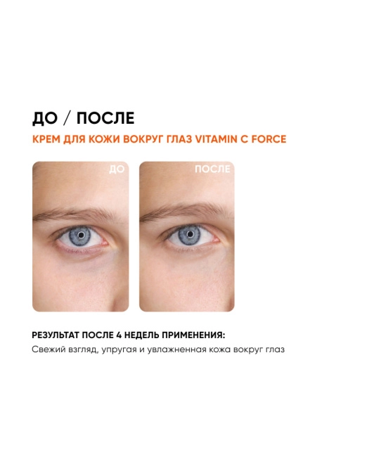 Icon skin Крем для кожи вокруг глаз с витамином С, 175мл (3)