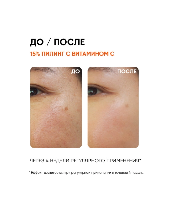 Icon skin Пилинг с витамином С 15%, 30мл (2)