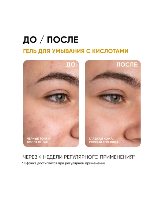 Icon skin Гель для умывания очищающий с кислотами, 150мл (2)