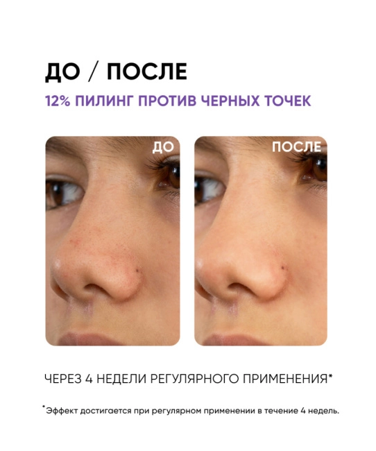 Icon skin Cмарт пилинг-система 12% AHA+BHA  / 12% AHA+BHA, 30мл (4)
