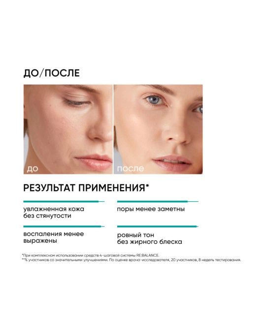 Icon skin Крем увлажняющий Aqua Essence / Aqua Essence Moisturizing Cream, 30мл (1)